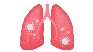 lung nutrients to stay healthy