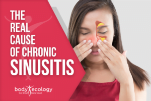 sinusitis